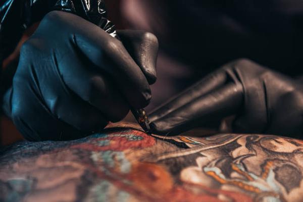 Tattoo Removal Consultations in Mississauga